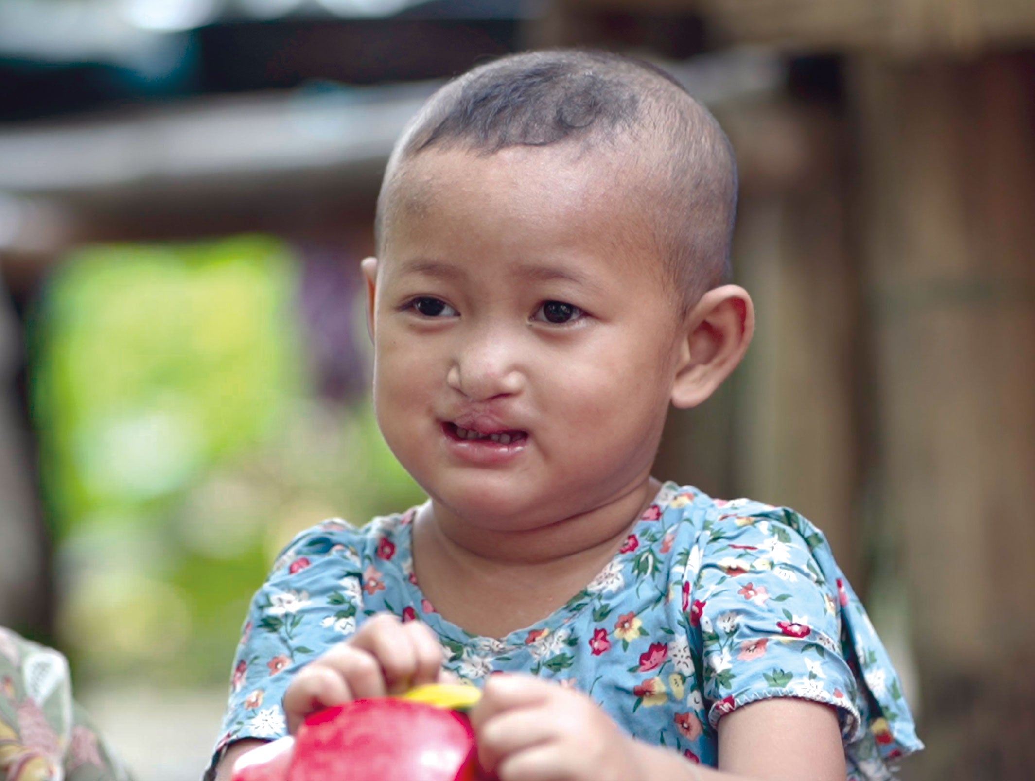 Nant Myo nach der Operation